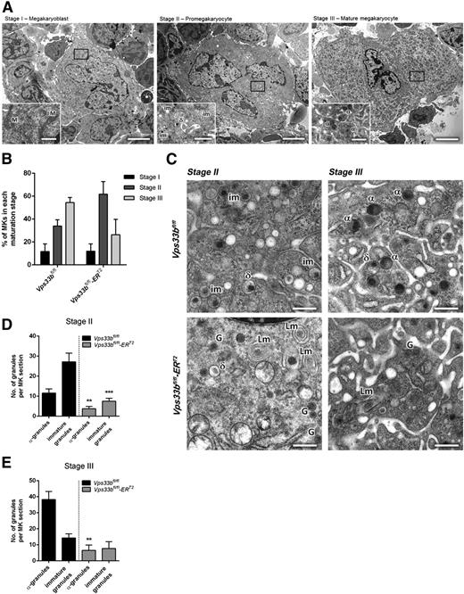 Figure 4. Abnormal ultrastructure of femoral BM Vps33bfl/fl-ERT2 MKs. (A) Representative transmission electron micrographs of femoral BM sections showing the classification of MKs in 3 main maturation stages. Scale bars, main image 5 μm; inset 1 μm. (B) Quantification of the percentage of MKs present per maturation stage in Vps33bfl/fl and Vps33bfl/fl-ERT2 mice (n = 32 to 44 MKs analyzed in 3 mice per genotype). (C) Vps33bfl/fl MKs showing nice distribution of granules in maturation stages II and III (top panels), whereas Vps33bfl/fl-ERT2 MKs were devoid of morphologically distinct α-granules but were abundant of small α-granule–like structures (bottom panels). Clusters of lamellar structures were also evident in Vps33bfl/fl-ERT2 MKs. Scale bar, 0.5 μm. (D-E) Quantification of α-granules and immature granules at maturation stage II (D) and III (E) reveals a marked decrease in their numbers in Vps33bfl/fl-ERT2 mice when compared with controls (n = 32 to 44 MKs analyzed in 3 mice per genotype). All values are mean ± SEM. **P < .01; ***P < .001. α, α-granule; δ, δ-granule; G, α-granule-like structure; im, immature granule; Lm, lamellar structure; M, mitochondrion.