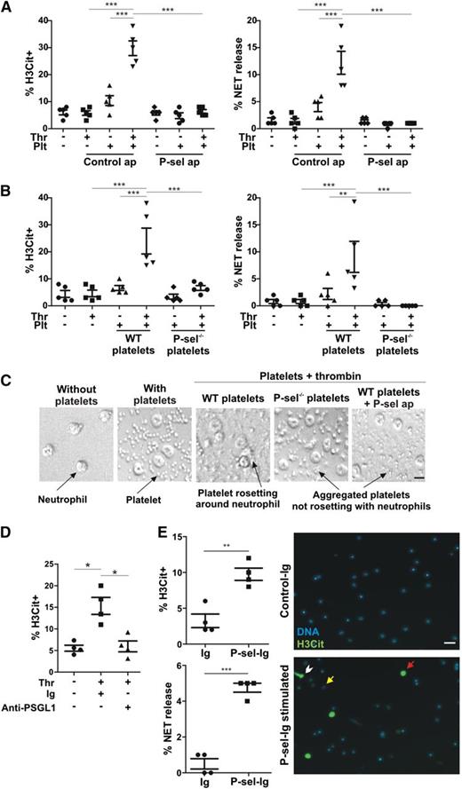 Figure 1. P-selectin is a stimulant of NET formation. (A) Neutrophils were incubated with unstimulated or thrombin (Thr)-stimulated platelets (Plt) in the presence of P-selectin aptamer inhibitor ARC5690 (P-sel ap) or ARC5694 as control aptamer (Control ap). H3Cit+ cells and NET formation were evaluated (n = 5; ***P < .001). (B) H3Cit+ cells and NET formation were quantified in neutrophils incubated with unstimulated or thrombin-stimulated platelets from WT or P-selectin−/− mice (P-sel−/−) (n = 5; **P < .01, ***P < .001). (C) The behavior of platelets in panels A and B was visualized by differential interference contrast microscopy. The images are representative from 5 experiments (scale bar represents 5 μm). (D) NET formation was examined after incubation with unstimulated or thrombin-stimulated WT platelets in the presence of anti-PSGL-1–blocking antibody or its immunoglobulin control (Ig). The percentage of H3Cit+ neutrophils was quantified (n = 4; *P < .05). (E) Left: WT neutrophils were stimulated with P-sel-Ig or with the same class of immunoglobulin as a control (n = 4; **P < .01, ***P < .001). Right: Representative fluorescence microscopy images of control immunoglobulin (Control-Ig) or P-sel-Ig treatments showing H3Cit-negative neutrophils (yellow arrow), H3Cit+ neutrophils without NET release (red arrow), and H3Cit+ neutrophils releasing NETs (white arrowhead). Scale bar represents 20 μm.