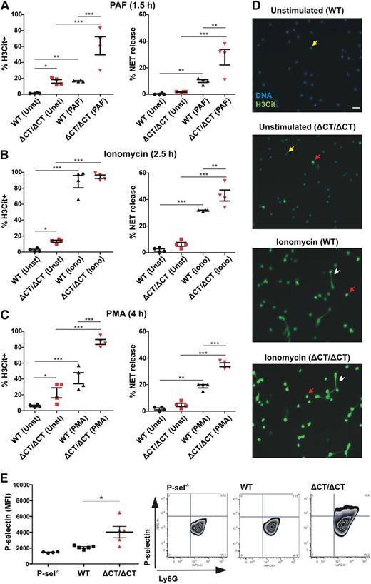 Figure 2. Neutrophils of P-selectinΔCT/ΔCT mice are primed to release NETs in vitro. Neutrophils isolated from peripheral blood of WT and P-selectinΔCT/ΔCT (ΔCT/ΔCT) mice were kept unstimulated (Unst) or stimulated with PAF (A), ionomycin (iono) (B), or PMA (C). The percentage of H3Cit+ neutrophils and NET release were quantified (n = 4; *P < .05, **P < .01, ***P < .001). (D) Representative fluorescence microscopy images of unstimulated or ionomycin-stimulated cells showing H3Cit-negative neutrophils (yellow arrow), H3Cit+ neutrophils without NET release (red arrow), and H3Cit+ neutrophils releasing NETs (white arrowhead). Scale bar represents 20 μm. (E) Left: Neutrophils isolated from peripheral blood of P-selectin−/−, WT, or P-selectinΔCT/ΔCT mice were double stained with APC-conjugated anti-Ly6G and FITC-conjugated anti-P-selectin, and the mean fluorescence intensity (MFI) of P-selectin-positive cells was analyzed in the neutrophil gate (Ly6G-positive cells) by flow cytometry (n = 4-5; *P < .05). Right: Representative fluorescence-activated cell sorter plots for each genotype.