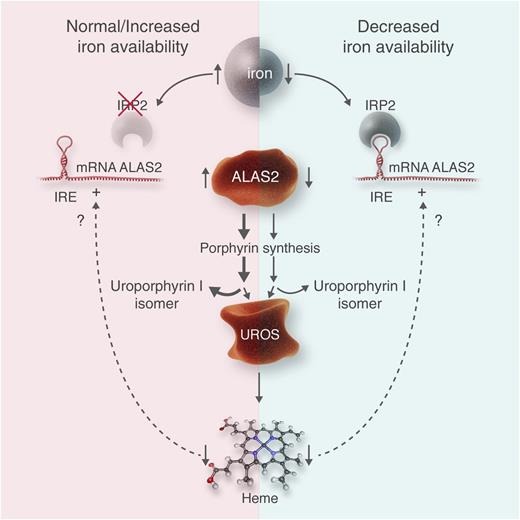 This figure illustrates the hypothesis of Egan et al1 and may be applied analogously to other erythropoietic porphyrias. (Left) A normal to increased iron availability is shown. Thereby, IRP2 is ubiquinated and destroyed, likely by an action of the iron-sensing protein “F-box and leucine-rich repeat protein 5.” IRE in the 5′ end of ALAS2 is unbound, and translation of ALAS2 protein proceeds. This leads to increased activity of this enzyme, controlling the rate of erythropoietic heme synthesis, and an increased overflow of porphyrin intermediaries such as uroporphyrin I in CEP. In CEP, the bottleneck of heme synthesis is the activity of the enzyme uroporphyrinogen III synthase (UROS), whereas in other erythropoietic porphyrias, other enzymes represent the bottlenecks, such as uroporphyrinogen decarboxylase in hepatoerythropoietic porphyria or ferrochelatase in erythropoietic protoporphyria. As shown by Barman-Aksözen et al,6 decreased heme synthesis increases ALAS2 activity by a yet-unknown mechanism. (Right) In an iron-deprived situation, IRP2 is active, binds to the IRE, and blocks ALAS2 translation. As less porphyrin intermediaries are synthesized, their overflow at the bottleneck of UROS is diminished, which reduces symptoms and improves survival of erythrocyte precursor cells in bone marrow. Similar effects of iron deprivation can be expected in other erythropoietic porphyrias. Professional illustration by Luk Cox, Somersault18:24.