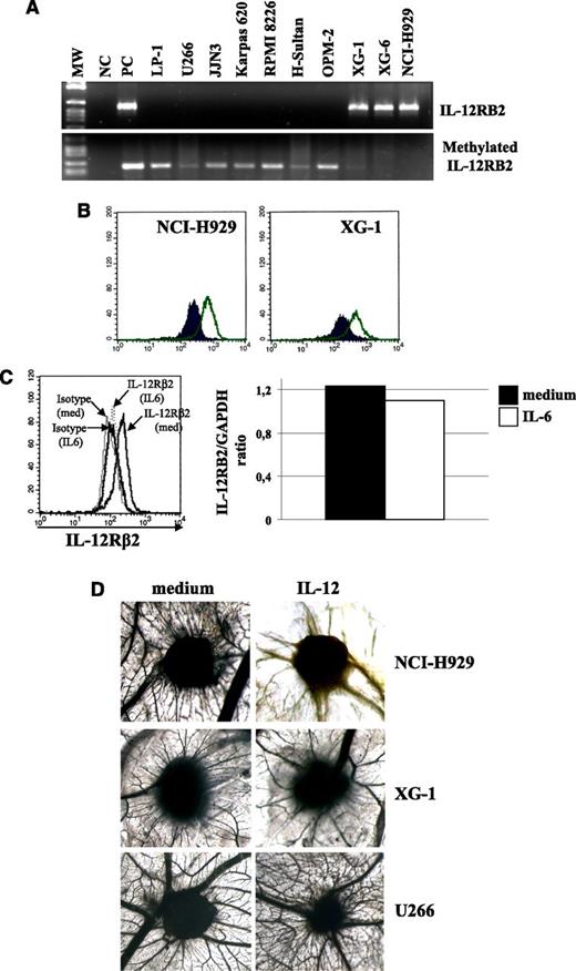 Figure 5. Expression and function of IL-12R in MM cells. (A) Top panel: IL-12RB2 expression in MM cell lines as assessed by RT-PCR. MW indicates molecular weight; NC, negative control (water in place of cDNA); PC, positive control (total tonsil B cells); different MM cell lines (LP-1, U266, JJN3, Karpas 620, RPMI 8226, H-Sultan, OPM-2, XG-1, XG-6, and HCI-H929) are shown. Bottom panel: Methylation specific PCR analysis of MM cell lines. MM cell lines that do not express the IL-12RB2 mRNA (LP-1, U266, Karpas 620, RPMI8226, H-Sultan, and OPM-2) show the amplification band corresponding to the methylated target sequence, whereas MM cell lines that express IL-12RB2 mRNA (XG-1, XG-6, and NCI-H929) failed to amplify the methylated sequence. MW, molecular weight; NC, negative control (water in place of DNA); PC, positive control (RAJI cells). (B) IL-12RB2 expression in NCI-H929 and XG-1 MM cell lines, as assessed by flow cytometry using the anti-IL-12Rβ2 antibody from Santa Cruz. Open profile represents IL-12Rβ2 staining; dark profile, isotype-matched antibody staining. (C) Left panel: IL-12Rβ2 protein expression in NCI-H929 cells cultured with medium alone or with hrIL-6 for 48 hours, as assessed by flow cytometry using the Santa Cruz antibody. Right panel: Quantitative analysis of IL-12RB2 versus GAPDH transcript in the same NCI-H929 cell suspensions analyzed in the left panel, cultured with (□) or without (▪) IL-6. (D) Angiogenic activity of supernatants from NCI-H929 (top panels), XG-1 (middle panels), and U266 (bottom panels) cells cultured in the presence or absence of hrIL-12, as assessed by CAM assay.