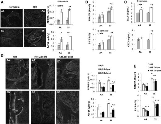 Figure 2. Hypoxia/reoxygenation stress (H/R) affects bone homeostasis in sickle cell mice. Zoledronic acid prevents H/R-induced increased turnover and osteoclast activation. (A) Left panel: representative images of calcein-labeled bone surface. Right panel: bone formation rate (BFR/BS) and activation frequency (AcF) in healthy (AA) and sickle cell (SS) mice under normoxia and exposed to H/R stress. Data are shown as mean ± SD (n = 6); *P < .05 compared with AA; °P < .05 compared with normoxic mice. (B) N.Oc/TA, osteoclast number/tissue area; ES/BS, erosion surface/bone surface in AA and SS mice under normoxia and exposed to H/R stress. Data are shown as mean ± SD (n = 6); *P < .05 compared with AA; °P < .05 compared with normoxic mice. (C) Serum levels of bone alkaline phosphatase (bALP) and carboxy-terminal collagen crosslinks (CTX-I) in AA and SS mice under normoxia and exposed to H/R stress. Data are shown as mean ± SD (n = 6); *P < .05 compared with AA; °P < .05 compared with normoxic mice. (D) Left panel: representative images of calcein-labeled bone surface. Right panel: BRF/BS and AcF in AA and SS mice exposed to H/R stress without and with Zol treatment before (pre-Zol) or after (Zol-post) H/R stress. Data are shown as mean ± SD (n = 6); *P < .05 compared with healthy mice; °P < .05 compared with vehicle treated mice; ^P < .05 Zol-pre compared with Zol-post. (E) N.Oc/TA and ES/BS in AA and SS mice exposed to H/R stress without and with Zol treatment before (Zol-pre) or after (Zol-post) H/R stress. Data are shown as mean ± SD (n = 6); *P < .05 compared with AA; °P < .05 compared with vehicle-treated mice.