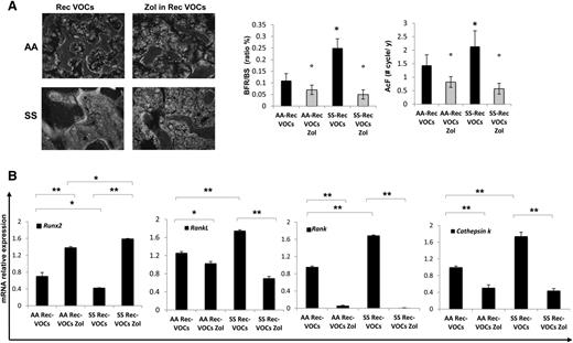 Figure 5. Recurrent acute vaso-occlusive crisis (VOCs) increases bone turnover, downregulates osteoblastogenesis, and upregulates osteoclastogenesis in sickle cell mice. Zoledronic acid (Zol) prevents bone impairment induced by repeated VOCs. (A) Left panel: representative images of calcein-labeled bone surface. Right panel: bone formation rate (BFR/BS) and activation frequency (AcF) in healthy (AA) and sickle cell (SS) mice exposed to recurrent (Rec) acute VOCs without and with Zol. Data are shown as mean ± SD (n = 6); *P < .05 compared with healthy mice; °P < .05 compared with vehicle-treated mice. (B) Runx2, RankL, Rank, and Cathepsin k mRNA fold changes in AA and SS mice exposed to recurrent (Rec) acute VOCs without and with Zol. Two different housekeeping genes (Gapdh and β-Actin) were used to perform real-time PCR analysis. Data are shown as mean ± SD (n = 6); *P < .05; **P < .005.