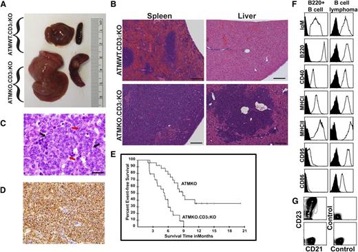 Figure 1. ATMKO.CD3εKO mice develop early-onset B-cell lymphomas in spleen and liver that resemble DLBCL. (A) Representative image of spleens (right) and livers (left) from ATMWT.CD3εKO and ATMKO.CD3εKO mice. (B) Hematoxylin and eosin staining showing spleen and liver sections from ATMWT.CD3εKO (top) and ATMKO.CD3εKO mice (bottom) (original magnification ×10; bar represents 200 μm). (C) Hematoxylin and eosin staining of a spleen section prepared from a tumor-bearing ATMKO.CD3εKO mouse (original magnification ×1000; bar represents 20 μm). Red and black arrows denote centroblasts and immunoblasts, respectively. (D) B220 staining of a spleen section from a tumor-bearing ATMKO.CD3εKO mouse (original magnification ×400; bar = 100 μm) using 3,3′-diaminobenzidine tetrahydrochloride as chromogen. Images were viewed with an Olympus BX41 microscope and photographed with an Olympus DP71 camera. Dynamic positioning controller software (version 3.3.1.292) was used for image acquisition. (E) The probability of dying with a tumor was determined using the Kaplan-Meier method. Kaplan-Meier analysis of tumor incidence studies in ATMKO.CD3εKO (n = 25) and ATMKO (n = 24) mice. ATMKO.CD3εKO mice died with B-cell lymphomas and ATMKO mice died with thymic T-cell lymphomas. No thymic T-cell lymphomas were observed in ATMKO.CD3εKO mice and no B-cell lymphomas were detected in ATMKO mice. No ATMWT.CD3εKO or ATMWT mice died with lymphomas. Mice euthanized and not found to have either a B- or T-cell tumor had their observations censored in the analysis. (F) Flow cytometric analysis of IgM, B220, CD40, MHC class I (MHCI; Kb), MHC class II (MHCII; IAb), CD95, and CD86 expression (open histogram) or isotype control staining (shaded histogram) on normal splenic B cells (gated on IgM+ cells) and on 1 representative ATMKO.CD3εKO B-cell lymphoma. (G) CD21 and CD23 expression on splenic B220+ B cells and 1 ATMKO.CD3εKO B-cell lymphoma. These histograms are representative of results obtained from 20 individual tumors. Data acquisition was performed using a FACSCaliber flow cytometer (BD Biosciences), and FlowJo software (Tree Star) was used for analysis.