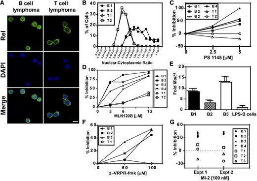 Figure 5. NF-κB expression and dependence of ATMKO.CD3εKO B-cell lymphomas. (A) Immunofluorescence images showing staining for Rel (Alexa488), 4,6 diamidino-2-phenylindole (DAPI), or both in an ATMKO.CD3εKO B-cell tumor (left) and an ATMKO T-cell tumor (right) (original magnification ×40). Images were collected at room temperature using a Zeiss LSM510 META confocal microscope fitted with a 63× oil-immersion lens. (B) Quantification of mean nuclear/cytoplasmic intensity ratio for Rel staining shown for 2 B-cell tumors (closed symbols) and 2 T-cell tumors (open symbols) and calculated from 200 images collected for each tumor. Inhibition of ATMKO.CD3εKO B-cell tumors (closed symbols) and ATMKO T-cell tumors (open symbols) cocultured with the IKK inhibitors PS1145 (C) or MLN120B (D). (E) quantitative polymerase chain reaction detection of Malt1 expression in B-cell tumors (B1, B2, and B3) and lipopolysaccharide (LPS)-activated B cells. Data were collected on the ABI 9700 real-time polymerase chain reaction system (Applied Biosystems), and relative expression of Malt1 was determined using the 2−ΔΔCT method, normalized to β-actin expression, and presented as fold expression (± standard deviation) relative to LPS-activated B cells. This experiment is representative of 3 independent experiments for each sample. Inhibition of B-cell tumors (closed symbols) and T-cell tumors (open symbols) cocultured with the MALT1 inhibitors Z-VRPR-fmk (F) or M1-2 (G). For panels C-D and F-G, viable cells were counted and inhibition was calculated as described. Data are representative of 3 independent experiments examining survival of 4 to 6 B-cell tumors and 2 to 4 T-cell tumors in each experiment.