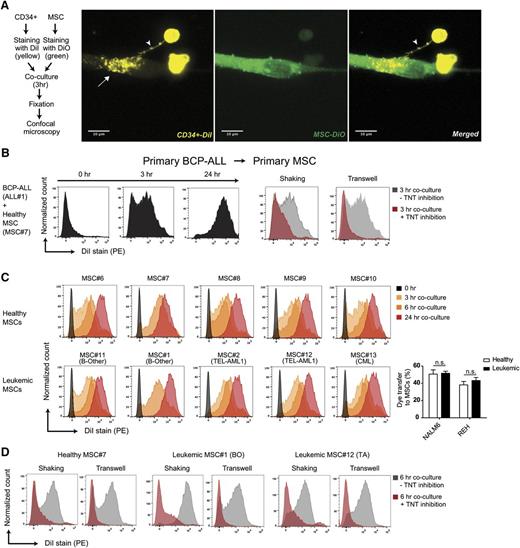 Figure 2. Primary BCP-ALL cells signal to MSCs via TNTs. (A) Representative confocal images (Z-stack) showing TNT formation (white arrowhead) between a primary CD34-positive cell (DiI, yellow) and a hTERT-immortalized MSC (DiO, green) after coculture for 3 hours. White arrow indicates transfer of dye to recipient cell. (B) Graphs showing quantification of dye transfer in cocultures of BCP-ALL patient cells with primary MSCs (cultured in 4:1 ratio). Inhibition of TNTs was performed by gentle shaking of cocultures, or coculture in a 3.0-μm transwell system (red histograms). (C) Graphs showing quantification of dye transfer from DiI-stained NALM6 cells toward 10 different unstained primary MSCs (cultured in 4:1 ratio) obtained from leukemia patients (n = 5) and healthy controls (n = 5). (D) Graphs showing quantification of dye transfer from DiI-stained NALM6 cells toward 3 different primary MSCs with (red histograms) or without (gray histograms) TNT inhibition (see also supplemental Figures 4-8).
