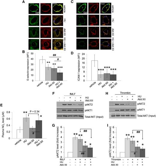 Figure 2. The effects of HU and Akti XII on the expression of E-selectin and ICAM-1, plasma NOx levels, and AKT2 phosphorylation in TNF-α-challenged Berkeley mice. (A-D) Following intravital microscopy, the cremaster muscle was excised, fixed, and embedded in paraffin for immunohistochemistry. Sections of the muscle were labeled with rat anti-mouse E-selectin or ICAM-1 and then Dylight 488-labeled anti-rat immunoglobulin G antibodies, followed by incubation with phycoerythrin-labeled anti-PECAM-1 antibodies and a mounting reagent containing 4,6 diamidino-2-phenylindole. (A,C) Representative images of E-selectin or ICAM-1 and PECAM-1 staining. (B,D) The geometric mean fluorescence intensities (MFI) of E-selectin or ICAM-1 expression in venules of Berkeley mice. Data represent the mean ± standard deviation (SD) (n = 45-57 venules in 6-8 mice per group). (E) Following intravital microscopy, plasma NOx levels were measured as described in supplemental Methods. Data represent the mean ± SD (n = 6-8 mice per group). (F-I) Berkeley mice were treated with saline, HU, Akti XII, or both HU and Akti XII as described in supplemental Methods. Neutrophils and platelets were isolated and stimulated with fMLF and thrombin, respectively. Immunoblotting was performed by using equal amounts of protein (50 μg) followed by densitometry using Image J software. Representative blots (F,H) and quantitation of AKT2 phosphorylation after normalization to total AKT expression in neutrophils (G) and platelets (I). Data represent the mean ± standard error of the mean (n = 6 mice per group). *P < .05, **P < .01, and ***P < .001 vs vehicle control; ANOVA and Dunnett’s test. #P < .05 and ##P < .01 between two groups; Student t test.