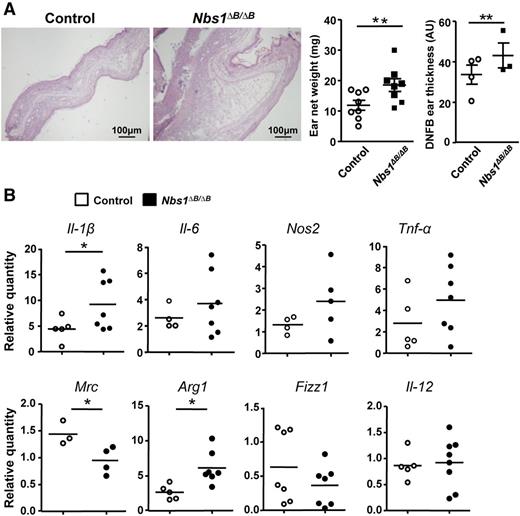 Figure 5. Exacerbated inflammation in Nbs1∆B/∆B mice treated with DNFB. (A) A representative sample of histologic images of DNFB-treated ears (at 7 day) is shown. At the right, the net weight of ears treated for 7 days with DNFB (8 mice) is shown. This was calculated by subtracting the weight of the DNFB-treated right ear from that of the acetone-treated left ear that was used as control. The ear thickness measurements were taken from the histologic images using Fiji software. Only DNFB-treated ear thickness is shown. AU, arbitrary unit. (B) Ear sample-derived mRNA was used to determine the expression of proinflammatory and anti-inflammatory markers by qPCR. The results are shown as individual values and as the mean of the 8 WT and 8 Nbs1∆B/∆B mice. *P < .05 and **P < .01 in relation to the corresponding controls.