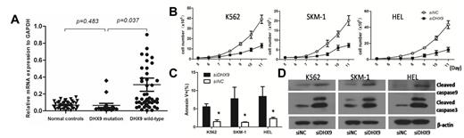 Figure 3. The mRNA expression of DHX9 in MDS and the effect of DHX9 knockdown in myeloid cell lines