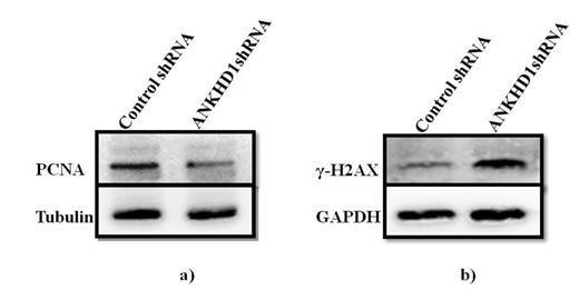 Figure 1. Western blot analysis of proteins: a) PCNA and b) γ-H2AX, in control and ANKHD1 silenced U266 MM cell line. Tubulin and GAPDH were used as endogenous controls.