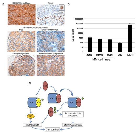 Figure 1. Expression of ADK and sensitivity to 6-ETI in plasma cell tumors. (A) BC3 cells ADK expression was evaluated by immunohistochemistry in the BC3 cell line, hyperplastic tonsils and PEL, multiple myeloma and plasmablastic lymphoma primary tumors. 60X original magnification is shown. In the image of a tonsil section, a positive cell with morphological features of a plasma cell is enlarged in the insert. Original magnification 60X. (B) LC50s for multiple myeloma cell lines treated with 6-ETI were determined by CellTiter-Glo assay. BC3 was used as a positive control and IBL1 as a negative control for drug sensitivity. Shown are the average of two independent experiments, where each condition was performed in duplicate in each experiment. (C) Model for 6-ETIÕs mechanism of action within the cell is illustrated, where 6-ETI competes with adenosine (ADO) and other nucleosides for binding to and phosphorylation by ADK, which inhibits ATP-dependent metabolic processes. This also allows 6-ETI to be phosphorylated and activated by ADK, with subsequent phosphorylation steps that allow the compound to be incorporated into DNA and possibly RNA, leading to DNA synthesis inhibition, DNA damage response, and cell death.