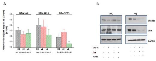 Figure 1. A) Levels of total, pS211 and pS203 GRα in Erys from HC, v1 and v2. B) levels of GRα and GRα phosphorylated at pS203 in Erys from HC and v1 exposed from 15' to Dex alone or in combination with the GR inhibitor RU486.