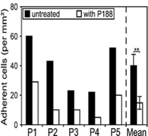 Figure 3. Graph representing adherent cells per mm2 at a flow rate of 1 dyne/mm2. The mean of the 5 patients is expressed as the average number of adherent cells/mm2 ± SD. Paired t test, P < 0.05.