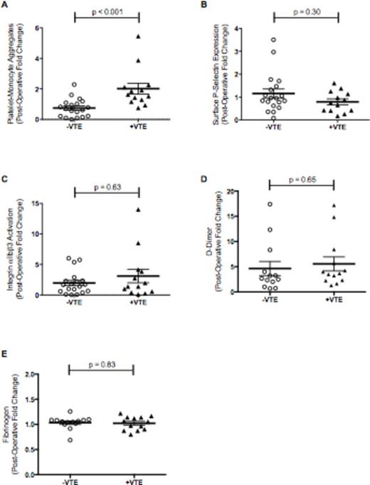 Figure 1. Circulating numbers of platelet-monocyte aggregates (Panel A) were increased post-operatively in patients with VTE (+ VTE, n=13), compared to patients without VTE (- VTE, n=19). In comparison, neither platelet surface p-selectin expression (Panel B) nor integrin αIIbβ3 activation (Panel C) predicted the development of VTE. Similarly, neither d-dimer (Panel D) nor fibrinogen (Panel E) predicted VTE (bars show mean±SEM).