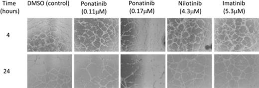 Figure 1. Ponatinib inhibits HUVEC tube formation. HUVECs were plated on Matrigel-coated plates in presence of DMSO, ponatinib, nilotinib or imatinib. Tube formation was evaluated after 4 and 24 h by light microscope. Representative fields (ª4 magnification) are pictured.