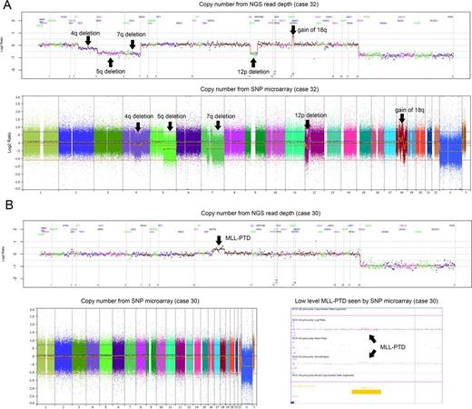 Figure 1. Examples of targeted CNVs detected by NGS and comparison to SNP microarray analysis.