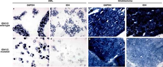 Figure 1. IDH1MT reduce maximal IDH1/2 activity, but IDH1/2 is a more important NADPH producer in glioblastoma than in AML compared with G6PD.