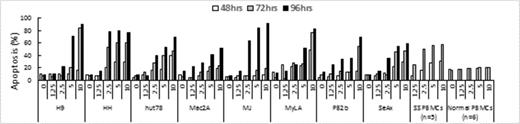 Figure 1. ONC201 induces apoptosis in CTCL cell lines and PBMCs from SS patients