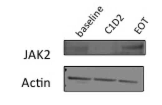 Figure 2. Western Blot analysis of total JAK2 from peripheral blood of patient at baseline, cycle 1 day 2, and end of treatment.