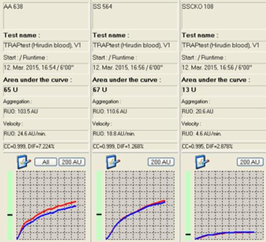 Figure 1. Impaired steady state whole blood platelet aggregation in SSCKO mice (panel 3).