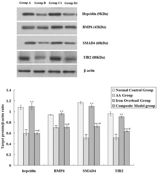 Figure 1. Western-blot a nalysis of hepcidin, BMP6, SMAD4 and TfR2 expression among groups