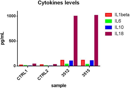 Figure 2. Cytokines levels before the administration of Tocilizumab. IL18, IL1beta, IL10, and IL6 serum levels were significantly elevated at two different time points (3512 and 3515) compared with the serum from two healthy donors (Control1, CTRL1; and control2, CTRL2).
