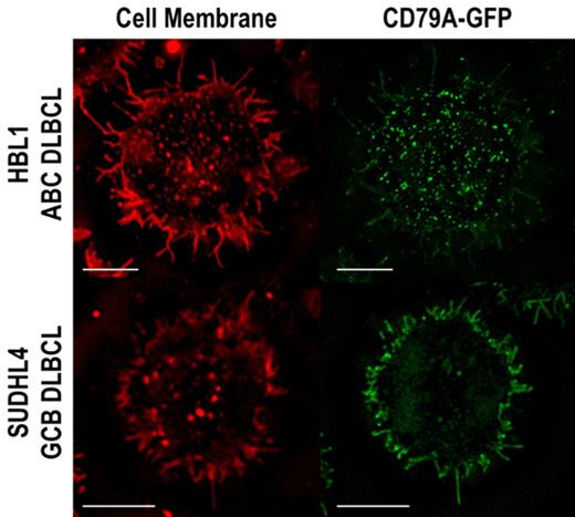Figure 2. Representative super-resolution images of BCR localization in live DLBCL cells. BCR labeled by CD79A-GFP fusion, surface membrane by CellMask staining. (bars = 5 µ m)