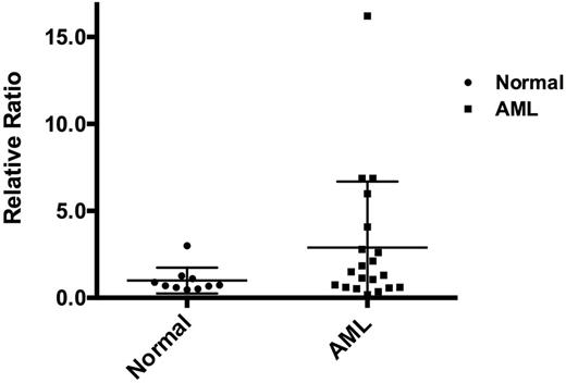 Figure 1. Expression of Pim1 in AML patients and control