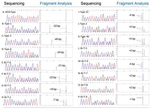 Figure 3. Figure 3 Sequencing traces show heterozygous mutation of CALR. Gene scan electropherogram from PCR method and partial sequence of CALR exon 9 from sequencing method (numbering according to GenBank access number: NC_000019.9). A-P: Detected a wild type and 15 CALR mutation types by sequencing and fragment analysis methods. A: wild type, B-I: deletions, H-L: insertions, M-P: complex indels.