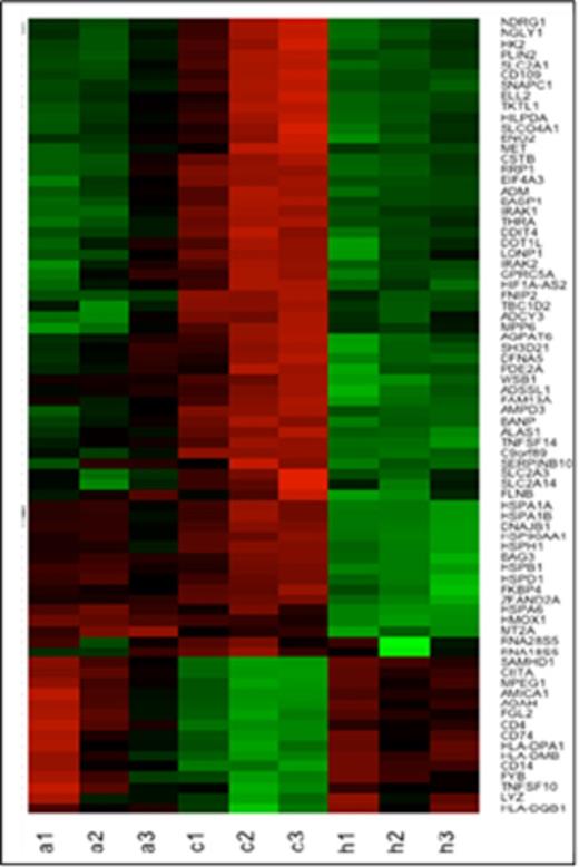 Figure 1. Heat map shows that the most differentially expressed genes (listed on the right) between normoxic control (c1,c2,c3) and hypoxic (1% O2) monocytes (h1,h2,h3) (defined as FDR<0.05, log2 fold change >3 and average expression >6 cpm) also show similar changes in normoxic monocytes exposed to AA5 (a1, a2, a3). (green high/red low expression).