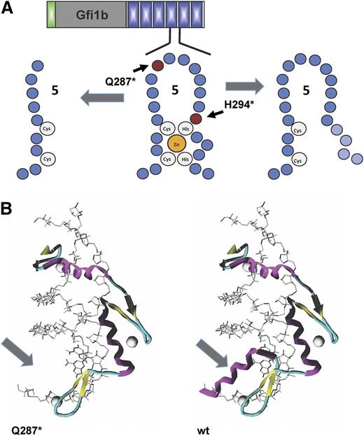 Figure 4. Effect of mutations on the structure of GFI1b. (A) Schematic structure of zinc finger 5 of Gfi1b and localization of the 2 mutations (Q287* and H294fs) found in families with inherited “bleeding disorder platelet-type, 17” (BDPLT17; OMIM 187900) or “Gfi1b-related thrombocytopenia” (GFI1B-RT). (B) The missense Q287* mutation introduces a premature stop codon in GFI1B causing a truncation and loss of the α helix strand in the third zinc finger domain in GFI1b (arrow).