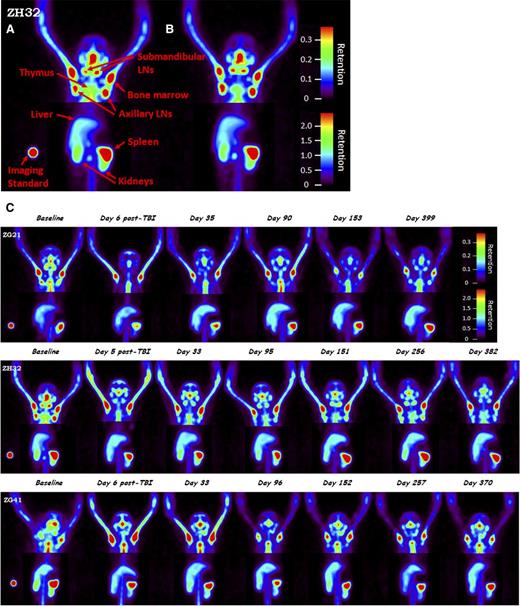 Figure 1. Evaluation of CD4+ cells in tissues for 4Gyx2 TBI-transplanted monkeys. Baseline (A) and 2 hours postmobilization with AMD3100 (B) SPECT maximum intensity projection image of ZH32 with arrows pointing to specific tissues along with imaging standard. Baseline and longitudinal SPECT maximum intensity projection images (C) for up to 1 year following TBI of ZG21, ZH32, and ZG41 rhesus macaques. All images are adjusted within and among monkeys on the maximum liver uptake. Different image contrasts were applied to head and abdominal field of views to highlight clusters of LNs and spleen. Grayscale images were converted to rainbow colors with appropriate retention scales, where red color indicates high retention.