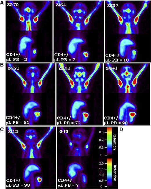 Figure 4. SPECT maximum intensity projection images. SPECT maximum intensity projection images comparing (C) 3Gyx2 (ZI12), (B) 4Gyx2 (ZG21, ZH32, ZG41), and (A) 5Gyx2 (ZG70, ZI64, and ZJ37) at day 6 post-TBI and (D) a chronically infected SHIVDH12R/SIVmac239 rhesus macaque (G43). Despite low circulating levels of CD4+ cells in all animals, residual CD4+ cells remain within LT such as the spleen following TBI, but more profound depletion is associated with chronic SHIV infection. Different image contrasts were applied to head and abdominal field of views to highlight clusters of LNs and spleen. Grayscale images were converted to rainbow colors with appropriate retention scales, where red color indicates high retention.