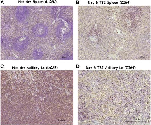 Figure 5. IHC of healthy and day 6 post TBI spleen and axillary LN tissues. (A-B) The comparison of spleen tissue stained for CD3+ cells in (A) a healthy control (DCAK) to (B) a 5Gyx2 monkey euthanized on day 6 post-TBI (ZI64). Residual lymphocytes (stained with a rabbit polyclonal anti-human CD3 antibody) were observed within the spleen but with a complete disruption of LN architecture in ZI64. (C-D) A similar comparison of axillary LN. These ex vivo data correlates with the SPECT imaging.