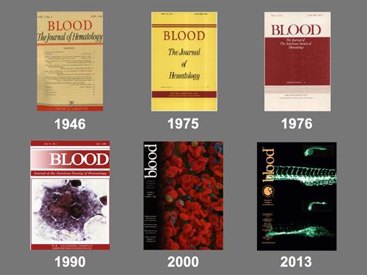 Figure 1. The cover of the very first issue of Blood and the cover of an early issue of Blood each time the journal changed the format of its cover.