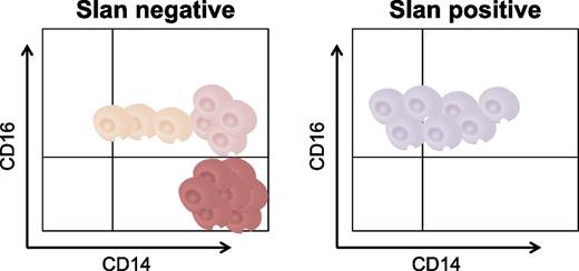 A new slan-based nomenclature for circulating CD16+ monocytes. slan identifies subsets of peripheral blood CD16+ monocytes that are differentially altered in frequency during sarcoidosis (increased frequency of slan-negative CD16+ monocytes in males) vs HDLS (reduced frequency of slan-positive CD16+ monocytes). This new slan-based classification offers a better understanding of monocyte development during homeostasis and disease pathogenesis.