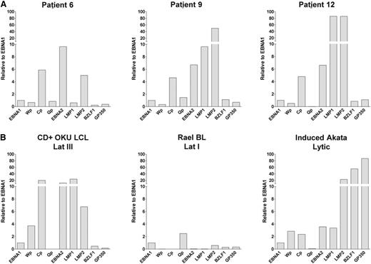 Figure 6. EBV gene expression in CD27+ memory B cells in high load allo-HSCT patients. Absolute numbers of EBV transcripts were quantified using a Q-PCR array. All data were first normalized to cellular PGK1 expression and then expressed relative to the levels of EBNA1 transcript. (A) EBV gene expression in CD27+ memory B cells sorted by FACS from patients 6, 9, and 12. (B) EBV gene expression in EBV-positive reference cell lines. CD+Oku LCL is a latently infected EBV-transformed B lymphoblastoid cell line characterized by activity of the Wp- and Cp promoters, and expression of EBNA1, EBNA2, LMP1, and LMP2 latent genes (a form of infection termed latency III). Rael-BL is a latently infected Burkitt lymphoma cell line which expresses a single latent gene EBNA1 transcribed from an alternative promoter Qp. Because both CD+Oku LCL and Rael-BL are tightly latent with only low-level expression of lytic cycle transcripts (exemplified by the immediate early gene BZLF1 and the late gene gp350), we also included a third reference line, AKBM Akata-GFP cells induced into lytic cycle by IgG crosslinking, to illustrate the much higher levels (typically >100-fold) of viral lytic gene transcription in productively infected cells.