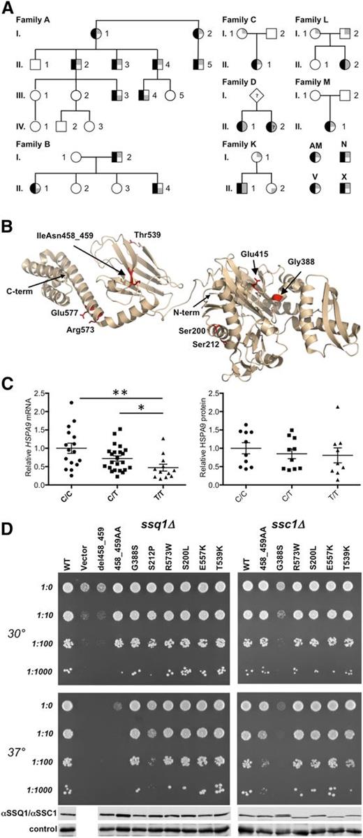 Figure 1. HSPA9 mutations in CSA. (A) HSPA9 CSA pedigrees. Affected status is indicated by black shading on the left of the symbol. The genotype is indicated on the right side of the symbol, in which gray shading in the upper and/or lower right quadrants indicates a low-frequency HSPA9 variant predicted to have functional consequences. When known, the paternal allele is indicated by shading in the lower right quadrant. A-I-1, A-I-2, A-II-1, A-II-2, A-II-3, A-II-4, A-II-5, A-III-1, A-III-2, A-III-3, A-III-4, and A-III-5 refer to I.1, I.2, II.1, II.2, II.6, II.7, II.19, III.2, III.3, III.4, III.9, and III.10, respectively, in van Waveren Hogervorst et al.6 A-IV-1, A-IV-2, and A-IV-3 were not included in van Waveren Hogervorst et al.6 Patient D-II-2 was not available for genotyping but had a phenotype identical to that of her sibling. (B) Mutations in HSPA9 mapped on the structure of bacterial HSP70 (Protein Data Bank ID: 2KHO). The N- and C-termini (term.) of the structure are noted. Human HSPA9 residues Ser200, Ser212, Gly388, Glu415, IleAsn458_459, Thr539, Arg573, and Glu577 were mapped to equivalent bacterial residues Ala149, Ala161, Gly342, Glu369, Ile412-Ala413, Ser493, Arg527, and Glu531. (C) Analysis of HSPA9 expression. Total mRNA was harvested from leukocytes (rs10117 genotype: number of samples analyzed; C/C: n = 16; C/T: n = 23; and T/T: n = 12); HSPA9 mRNA was assessed by quantitative real-time polymerase chain reaction and was normalized to β-actin. P values were calculated by using the Mann-Whitney test. **P < .005; *P < .05. Western blot analysis of HSPA9 protein expression in healthy individuals was grouped by rs10117 allele (C/C: n = 10; C/T: n = 10; and T/T: n = 9). Equivalent loading of mitochondrial lysate was confirmed by immunoblot analysis using an anti-adenosine triphosphate synthase, beta-subunit (ATPB) antibody. Protein expression was determined by densitometry analysis on a Biorad Chemidoc MP instrument with Image Laboratory 4.1 software. (D) Haploid ssq1Δ (left) and ssc1∆ (right) strains having plasmids harboring the indicated mutants, wild-type (WT) gene, or in the case of the viable ssq1∆ strain, a plasmid-lacking insert (vector). Tenfold serial dilutions were plated on minimal media and incubated at the indicated temperatures. Whole-cell lysates of the indicated strains were subjected to immunoblot analysis using polyclonal antibodies specific for SSQ1 (left), SSC1 (right) and, as a loading control, Ydj1. Names of the alleles correspond to the human HSPA9 numbering. For details of homologous yeast mutations, see supplemental Figure 1.