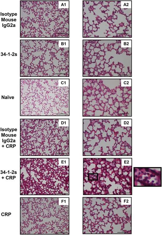 Figure 4. Lung tissue histology from BALB/c mice receiving the indicated transfusions of antibody and/or CRP. Mice were euthanized after 90 minutes following antibody and/or CRP injection and lungs were harvested for sectioning and histology analysis. Panels A1 to F1 and A2 to F2 represent lung tissue images taken at original magnification ×20 and ×40, respectively. Representative images of each indicated group are shown. A zoom of indicated square in E2 (lung section from mice treated with 34-1-2s + CRP) is depicted alongside and shows alveolar neutrophil infiltration. Scale bars represent 100 µM in panels A1 to F1 and 50 µM in A2 to F2.