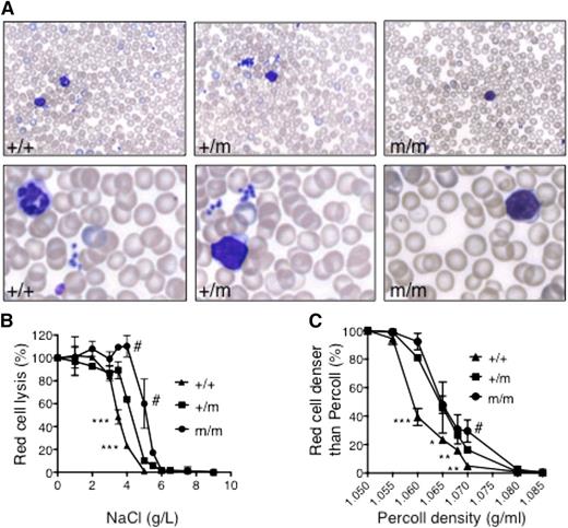 Figure 1. Red cell characteristics of RBC10 mice. (A) Peripheral blood smears from 7-week-old wild-type (+/+), RBC10 heterozygous (+/m), and homozygous (m/m) mice. (B) Osmotic fragility shows significantly reduced sensitivity of RBC10 mutant red cells. Plots are representative of 2 independent experiments using 3 animals of each genotype. (C) Red cell densities of wild-type, RBC10 heterozygous, and RBC homozygous mice determined by centrifugation through Percoll mixture of defined density. Student t test: wild type compared with RBC10 heterozygous: *P < .05, **P < .01, ***P < .001. RBC10 homozygous compared with heterozygous: #P < .05.