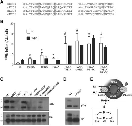 Figure 4. M935K mutation impairs phosphorylation of threonines in the cytoplasmic tail of Kcc1. (A) Alignment of human and mouse KCC1 and KCC3 showing sites of conserved methionine in relation to known regulatory threonines. (B) 86Rb influx in HEK293 cells expressing wild-type Kcc1 (WT) or various Kcc1 mutants in isotonic and hypotonic conditions. *P < .05 compared with WT; #P < .05 compared with M935K. (C) Western blot of anti-HA immunoprecipitates probed with anti-phosphothreonine (pThr) or anti-HA antibodies. D, dimer; M, monomer. (D) Western blot of anti-HA immunoprecipitates from HEK293 cells expressing wild-type or the homologous Kcc3 mutant M1000K demonstrating impaired phospho-threonine. (E) A schematic illustrating the regulation of KCC1 and the inhibitory effect of M935K mutation on nearby threonines leading to constitutive activation of K-Cl cotransport.