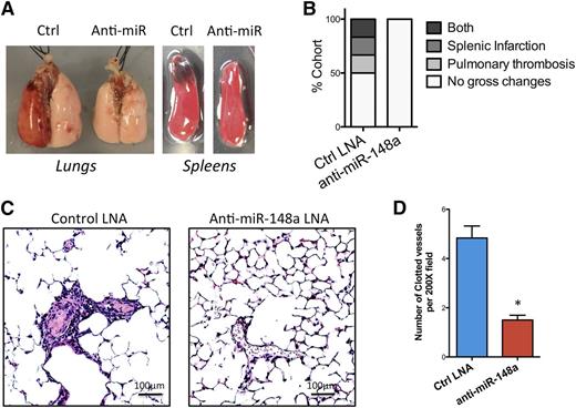 Figure 6. Inhibition of miR-148a in vivo is protective against FcγRIIA-mediated thrombosis. (A) Comparison of gross pathologic changes in mouse lungs and spleens between 2 experimental groups showing pulmonary thrombosis/hemorrhage, and splenic infarction. (B) Bar graph showing percentage of mice with pathologic changes (n = 6 for each group). (C) Microscopic examination of the mouse lungs after induction of thrombosis by anti-CD9 antibody treatment. (D) Quantification of total clotted vessels from lung histology. Images were captured with Carl Zeiss Axio Observer Z1 microscope and Leica Microsystems DFC 420 camera. Vessel count was conducted under light microscopy. Numbers of clotted vessels was recorded per 200× field. Three separate slides from each treatment group were analyzed (P < .01, n = 12).