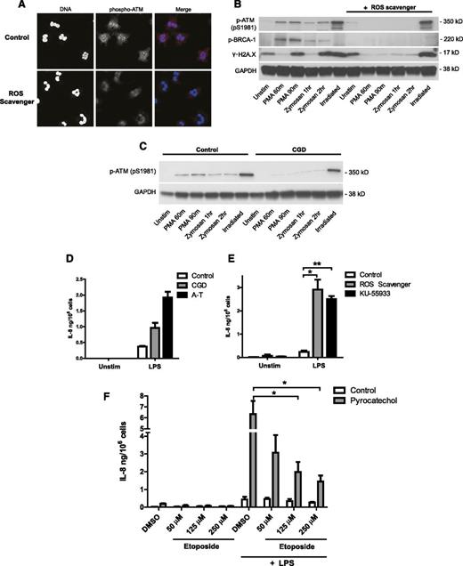 Figure 5. Neutrophil oxidative burst activates the DNA damage response and regulates cytokine production. (A-D) NADPH oxidase-derived ROS activates the DNA damage response in stimulated neutrophils. (A) Phospho-ATM (red) and DNA (blue) staining of healthy neutrophils activated with PMA in the presence of 30 μM ROS scavenger pyrocatechol. neutrophils were stimulated for 90 minutes with PMA to induce ROS production, fixed, permeabilized, stained with anti-pATM (pS1981) antibody, and visualized by confocal microscopy. (B-D) Western blot analysis of DNA damage-response activation in lysates from neutrophils stimulated with PMA, opsonized zymosan, or 10 Gy irradiation in the absence or presence of pyrocatechol (B), or isolated from control and CGD patient (C). (D-E) IL-8 production from neutrophils deficient in ATM activity and ROS production. (D) IL-8 production from neutrophils isolated concurrently from a CGD patient, an AT patient, and a healthy control after 18 hour of LPS stimulation (single experiment). Data are plotted as the mean ± SEM of triplicate stimulations. (E) IL-8 production from healthy control neutrophils incubated with ROS scavenger pyrocatechol or ATM inhibitor KU-55933, and stimulated for 18 hours with LPS (n = 3). IL-8 concentration in supernatants was measured by ELISA. (F) IL-8 production from neutrophils incubated with pyrocatechol, pretreated for 1 hour with indicated concentrations of etoposide, and stimulated for 18 hours with LPS (n = 3). (E-F) Data are presented as the mean ± SEM of compiled experiments. Asterisks indicate significance: *P < .05, **P < .01, ***P < .001 by paired Student t test.