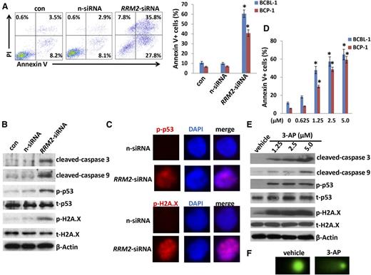 Figure 6. Directly targeting RRM2 induces PEL apoptosis through causing DNA damage. (A) BCP-1 and BCBL-1 were transfected with either negative control siRNA (n-siRNA) or RRM2-siRNA for 48 hours, then cell apoptosis was assessed using Annexin V-PI staining and flow cytometry analysis. (B-C) Protein expression was measured by immunoblots and immunofluorescence, respectively. (D-E) Cells were treated with indicated concentrations of RRM2 inhibitor, 3-AP, for 24 hours, then cell apoptosis and protein expression were measured as described in “Materials and methods.” Error bars represent the S.E.M. for 3 independent experiments; *P < .01. (F) Cells were treated with 5 μM 3-AP for 24 hours, then DNA damage was evaluated by using the CometAssay.