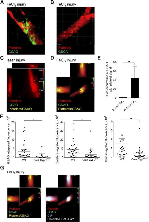 Figure 5. GSAO+ platelets form in occluding murine thrombi and are attenuated with megakaryocyte-directed deletion of the cyclophilin D gene. (A-B) Dylight 649-conjugated antiplatelet CD42b antibody and GSAO-Oregon Green or control compound GSCA-Oregon green were injected into the murine circulation and thrombus initiated in the cremaster muscle arterioles by FeCl3 injury. Thrombi were captured by confocal intravital video microscopy, and images are displayed as 3-dimensional reconstructions (maximum intensity projection mode). Occlusive thrombi incorporate GSAO-Oregon green, but not the control compound. (C-E) Dylight 649-conjugated antiplatelet CD42b and GSAO-Oregon Green were injected into the murine circulation and thrombus initiated in the cremaster muscle arterioles by either laser (C) or FeCl3 (D) injury. Thrombi were captured by confocal intravital video microscopy and images displayed as cross-sectional orthogonal views for single-plane colocalization. There was minimal GSAO signal in the nonocclusive thrombus initiated by laser injury, but extensive signal in the occlusive thrombus initiated by FeCl3 injury (C; n = 6-8 in 6-8 different mice; Manders correlation coefficient, **P < .01). (F) Dylight 649-conjugated anti-platelet CD42b antibody, GSAO-AF546, and AF488-conjugated anti-fibrin antibody were injected into the murine circulation of wild-type (WT) or platelet-specific cyclophilin D-deficient (PF4Cre+ CypDFl/Fl) mice and thrombus initiated in the cremaster muscle arterioles by FeCl3 injury. Thrombi were captured by confocal intravital video microscopy and images analyzed for integrated GSAO, platelet, and fibrin fluorescence (WT n = 4, 29 thrombi; PF4Cre+ CypDFl/Fl n = 3, 15 thrombi; *P < .05; **P < .001). (G) Dylight 649-conjugated anti-platelet CD42b antibody, GSAO-Oregon Green, and calcium-sensing dye rhodamine 2 were injected into the murine circulation and thrombus initiated in the cremaster muscle arterioles by FeCl3 injury. Thrombus was visualized 10 minutes after injury. Images are represented as cross-sectional orthogonal views of single confocal plane displaying platelets and GSAO (left) with rhodamine signal (right). Persistence of high calcium signal is demonstrated in the GSAO+ platelets consistent with necrotic cell death.