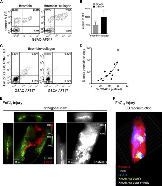 Figure 6. GSAO marks functionally procoagulant platelets. (A-B) Washed human platelets were stimulated with thrombin (0.1 U/mL) or thrombin (0.1 U/mL) and collagen (5 µg/mL), and phosphatidylserine externalization was assessed by annexin V binding. The mean fluorescence intensity of annexin V binding to GSAO− and GSAO+ platelets is shown in B. Flow plots and bars are representative of n ≥ 3 separate experiments. (C) Platelet-rich plasma was recalcified and stimulated with thrombin (1 U/mL) and collagen (5 µg/mL) with fibrin polymerization inhibition. FXa on the platelet surface was detected using the small molecule inhibitor, Glu-Gly-Arg chloromethyl ketone-fluorescein isothiocyanate. Of the FXa+ platelets, 93% were co-labeled with GSAO. (D) Washed human platelets were stimulated with thrombin (0.1 U/mL) or thrombin (0.1 U/mL) and collagen (5 µg/mL), and their procoagulant potential was assessed using the Calibrated Automated Thrombogram. Correlation between peak thrombin time and the percentage of GSAO+ platelets in the preparation (n = 18). The dotted line is the nonlinear least squares fit of the data to a single exponential (r2 = 0.77; P < .001). (E) Dylight 649-conjugated anti-platelet CD42b antibody, GSAO-AF546, and AF488-conjugated anti-fibrin antibody were injected into the murine circulation and thrombus initiated in the cremaster muscle arterioles by FeCl3 injury. Images are represented as cross-sectional orthogonal views of single confocal plane separately displaying GSAO and fibrin signal (left) and platelet signal (right). Fibrin signal preferentially localized with the GSAO+ platelets (representative image, n = 9 images in 3 independent mice). (F) 3D reconstruction of an occlusive thrombus.
