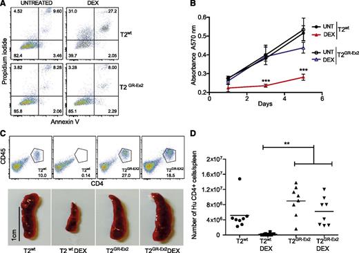 Figure 2. TALEN-modified T2-cell resistance to DEX in vitro and in vivo. (A) Apoptosis of T2wt cells and T2GR-Ex2 cells measured by annexin V and propidium iodide staining. Cells were cultured with DEX (10−4 M) for 72 hours, and the proportion of cell death was determined as positivity (right quadrants) for propidium iodide, annexin V, or both. (B) Time-response curves for cell proliferation of T2wt (closed symbols) or T2GR-Ex2 (open symbols) treated with DEX by using a typical 3-(4,5-dimethylthiazol-2-yl)-2,5-diphenyltetrazolium bromide assay. Data are represented as means ± standard deviation from 3 independent experiments; statistical analysis was performed by 1-way ANOVA (***P < .001). (C) Splenic engraftment of T2wt or T2GR-Ex2 cells stained by human anti-CD45 and anti-CD4. Photographs depict the smaller size of harvested spleens from DEX-treated T2-injected recipients. A total of 5 × 106 T2wt or T2GR-Ex2 cells were IV injected into irradiated NSG mice treated daily with intraperitoneally injected DEX at 15 mg/kg or vehicle for 12 days. (D) Total number of human CD4+ cells per spleen. Data depict means from 2 independent experiments with 4 mice per group; statistical analysis was performed by 1-way ANOVA (**P < .01) with Bonferroni multiple comparisons (a nonparametric Student t test between T2 and T2 DEX groups revealed a P value of .0034). ANOVA, analysis of variance.