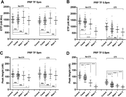Figure 3. Comparison of ETP and peak height measured in PRP samples in control subjects and FXI-deficient individuals. Discrimination between 41 control subjects and FXI-deficient patients divided into 3 groups: partial deficiency (FXI:C 16-60 IU/dL, n = 72), major deficiency 1 (Major 1) (FXI:C 3-15 IU/dL, n = 10), and major deficiency 2 (Major 2) (FXI:C ≤2 IU/dL, n = 8) using the TG assay triggered at TF 5 pM (A,C) and TF 0.5 pM (B,D). ETP (A-B) and peak height measurements (C-D) are compared in PRP samples with or without CTI. *P < .5, **P < .01, ***P < .001, ****P < .0001; ns, not significant.