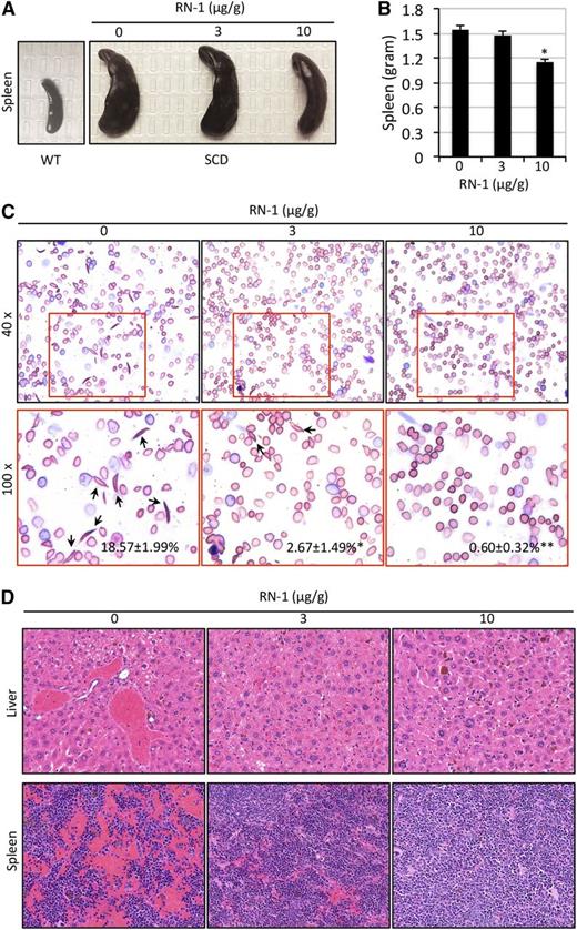 Figure 5. Reduced organ damage and RBC sickling in SCD mice treated with RN-1. (A-B) SCD mice treated with RN-1 exhibited modestly reduced splenomegaly. The size (A) and the weight (B) of spleens are depicted (*P < .05 vs untreated SCD mice). (C) Wright-Giemsa staining of peripheral blood smears of SCD mice before and after daily RN-1 administration for 1 month. Arrows indicate sickled cells. The average percentage of sickle cells in each group is presented as the mean ± SD (n = 4-6 mice per group) (*P < .05; **P < .01). (D) H&E staining of liver and spleen sections from untreated or RN-1–treated SCD mice.