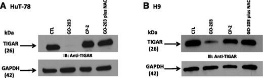 Figure 4. TIGAR expression is decreased by MUC1 inhibition via ROS. (A-B) HuT-78 and H9 cells were left untreated and treated with 5 μM GO-203 or 5 μM CP-2 each day for 3 days. The GO-203-treated cells were also incubated in the presence of 5 mM NAC for the last 2 days. Lysates were immunoblotted with the indicated antibodies.